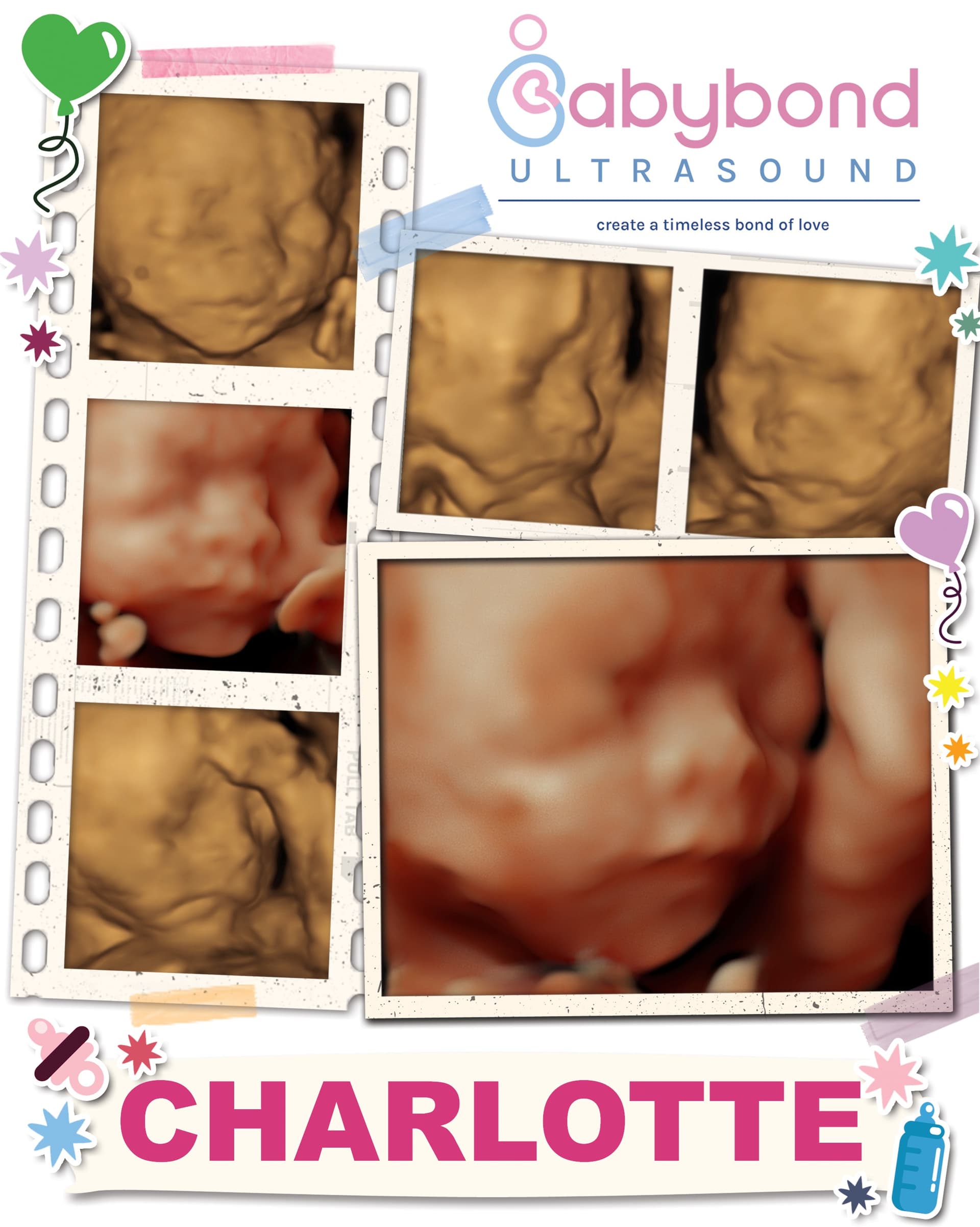 Charlotte's 4D ultrasound collage