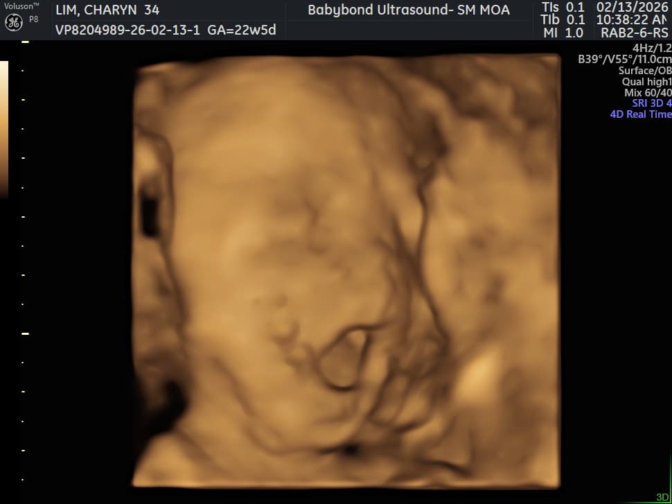 Charlotte ultrasound 1