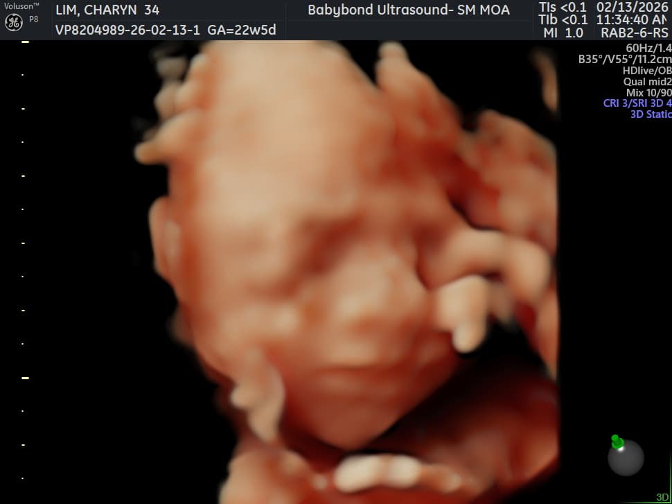 Charlotte ultrasound 10