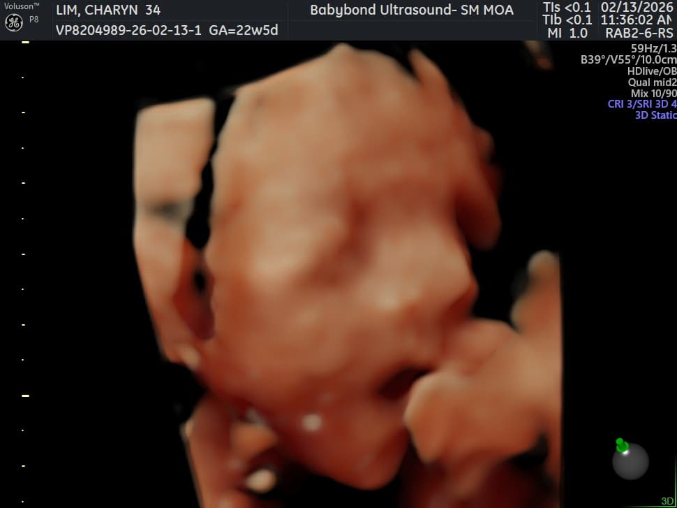 Charlotte ultrasound 11