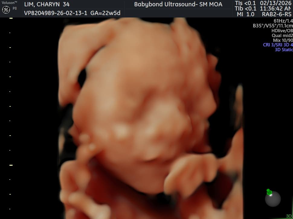 Charlotte ultrasound 12