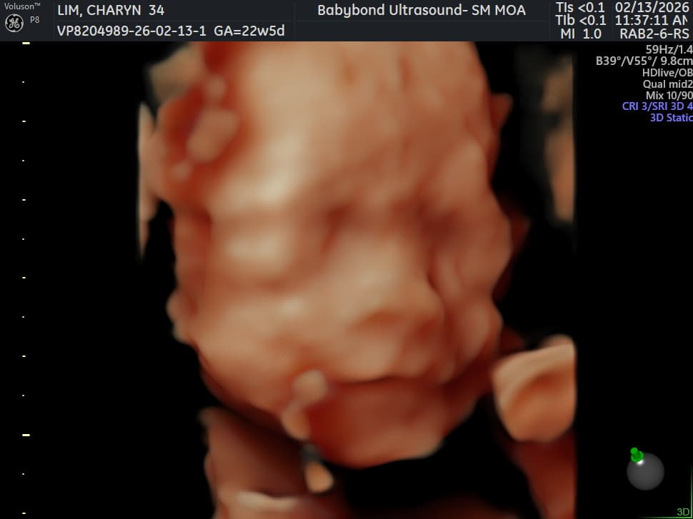 Charlotte ultrasound 13