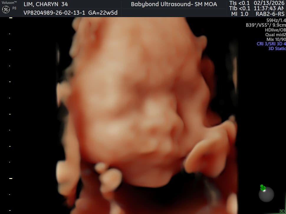 Charlotte ultrasound 14