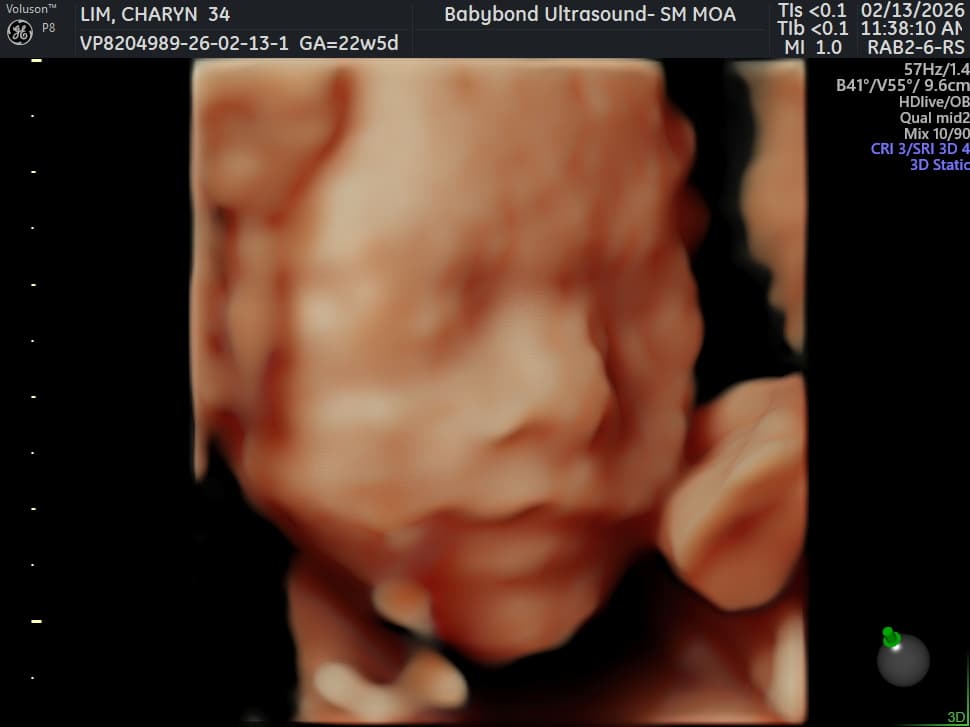 Charlotte ultrasound 15
