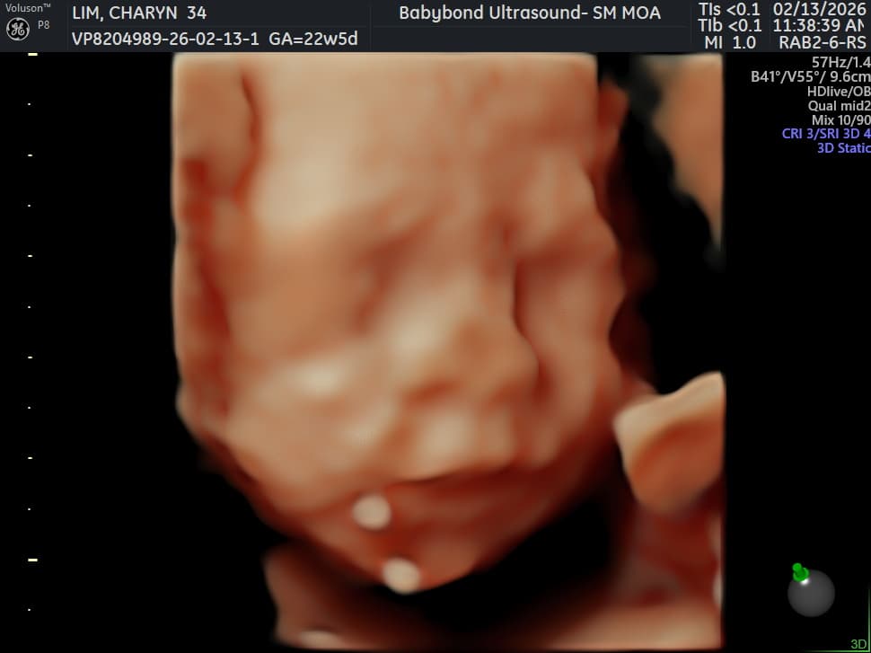 Charlotte ultrasound 16