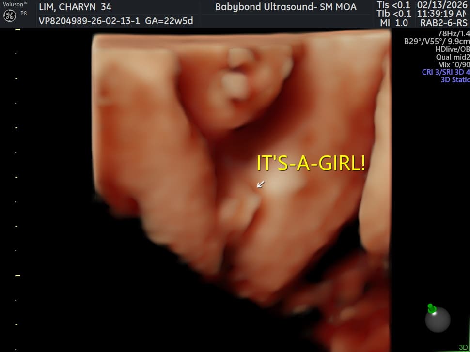 Charlotte ultrasound 17