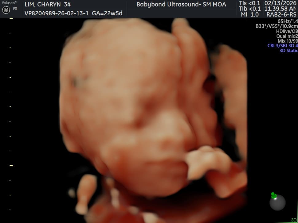 Charlotte ultrasound 18