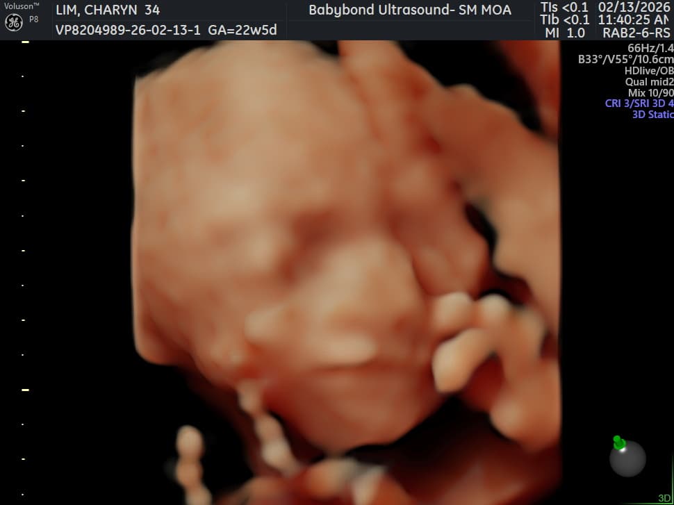 Charlotte ultrasound 19