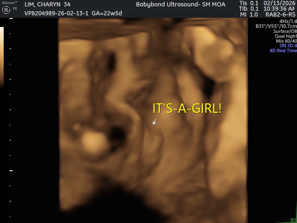 Charlotte ultrasound 2