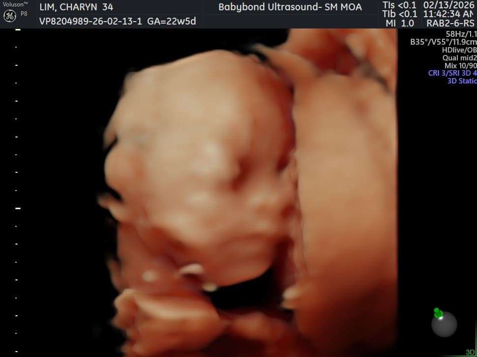 Charlotte ultrasound 20