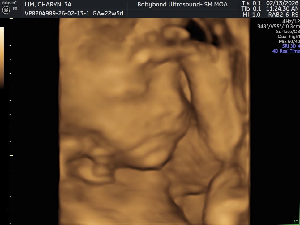 Charlotte ultrasound 21