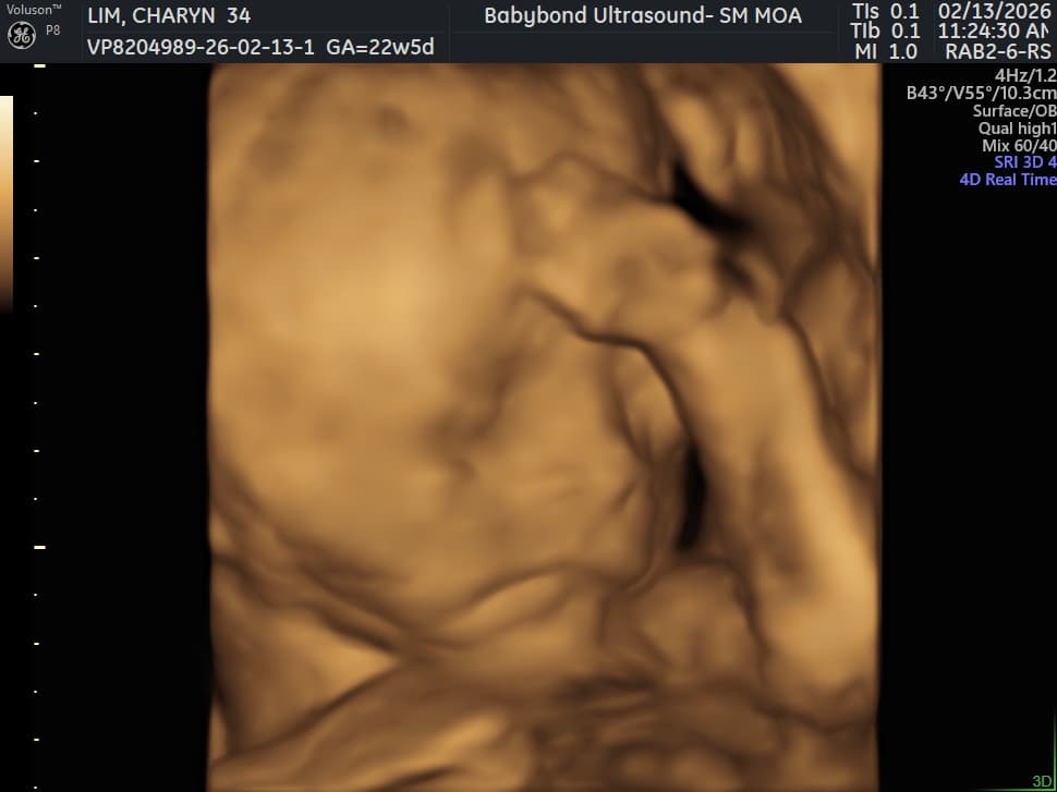 Charlotte ultrasound 22