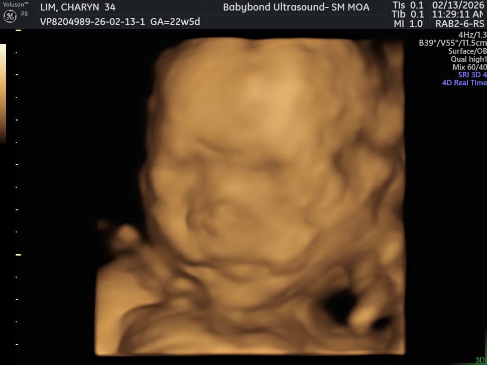 Charlotte ultrasound 23