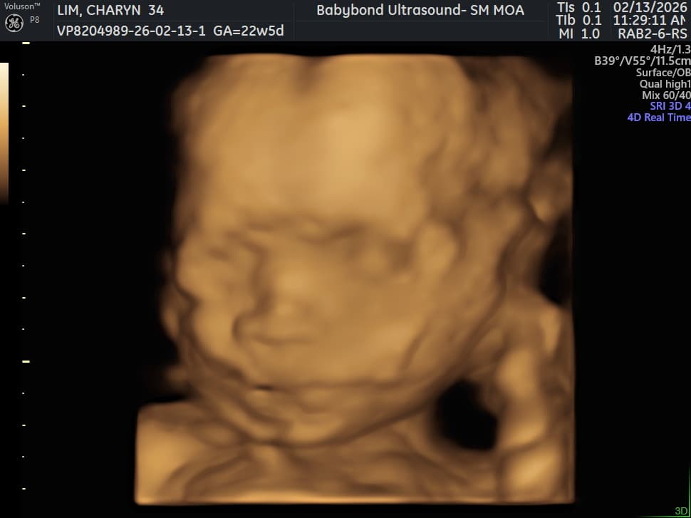 Charlotte ultrasound 24