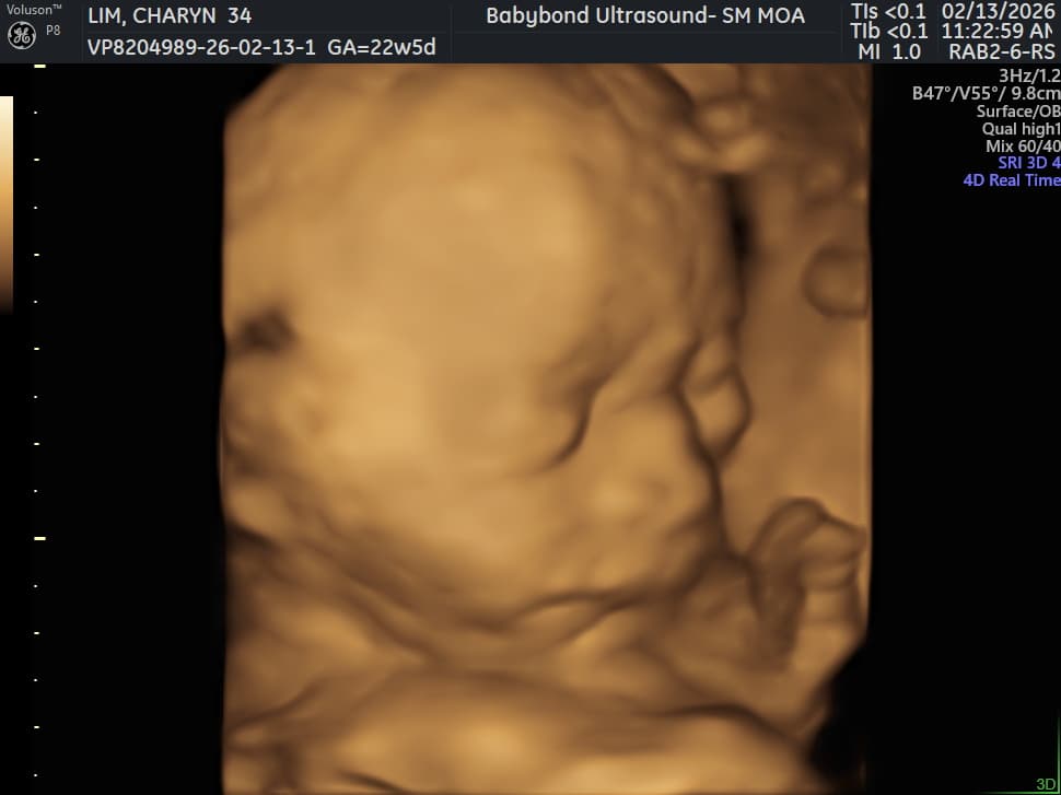 Charlotte ultrasound 3