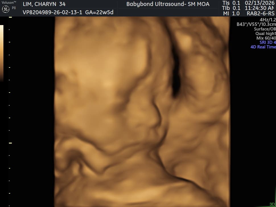 Charlotte ultrasound 4