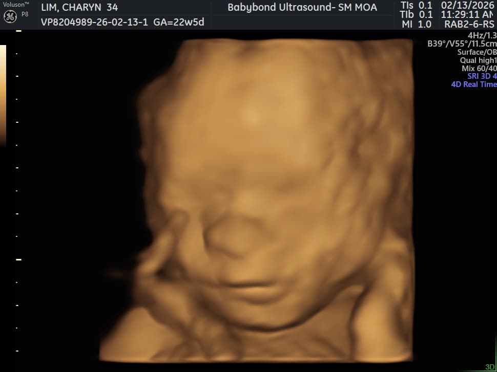Charlotte ultrasound 5