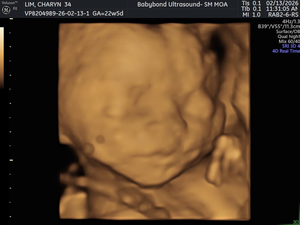 Charlotte ultrasound 6