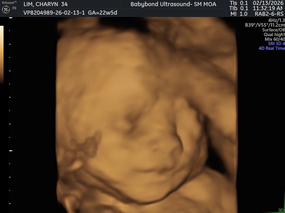 Charlotte ultrasound 7