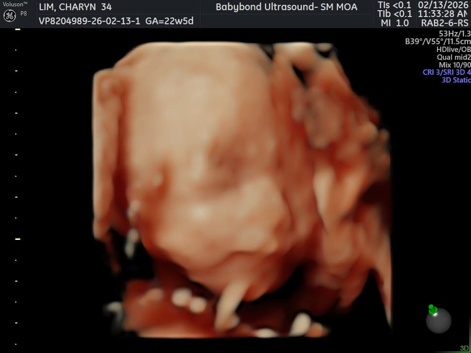 Charlotte ultrasound 8