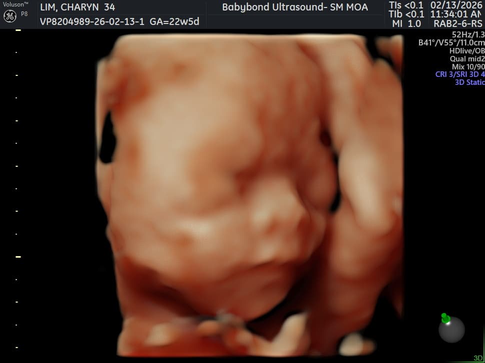Charlotte ultrasound 9